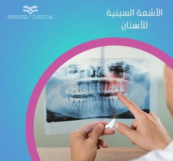 أشعة الأسنان