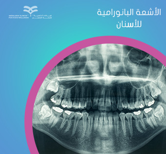 الأشعة البانورامية