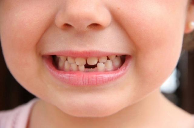 dental-implants-for-children-dentist.jpg