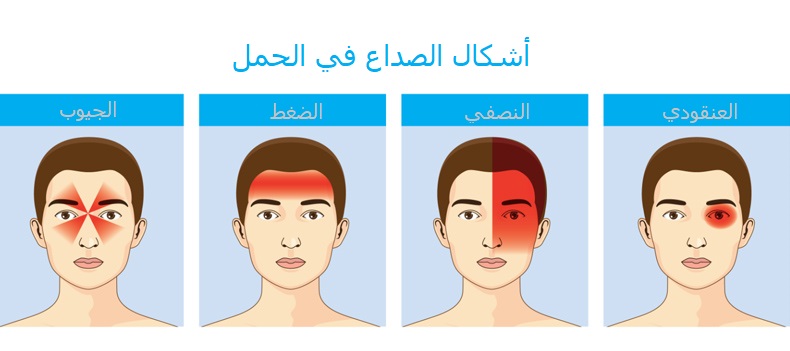يعتبر الصداع من الأعراض الشائعة في فترة الحمل