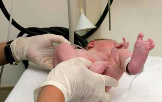 ما هو الختان