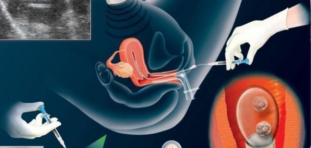 ما هو طفل الانبوب